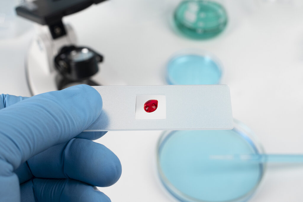 view-laboratory-test-tube-samples